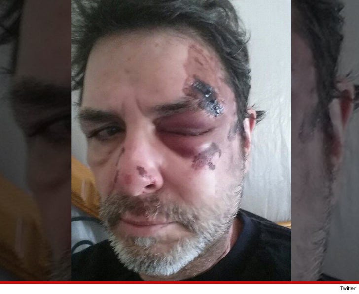 Big Brother' Winner Evel Dick -- I Got Hit By :: 0419-evel-dick-injuries-twitter-4