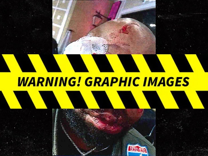 Darnell Greene's Alleged Injuries
